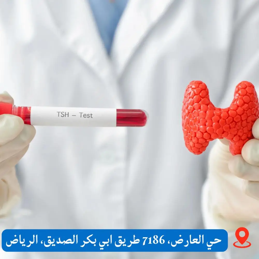 تحليل TSH ودلالته